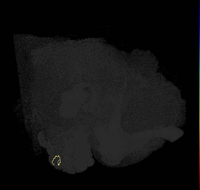 ORN_VA2 (FlyEM-HB:2198579859)