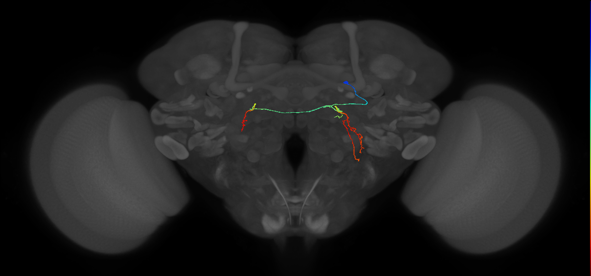 PS087_R (FlyEM-HB:1467685454)