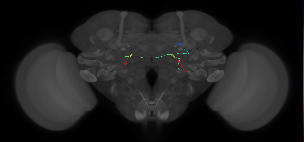 PS087_R (FlyEM-HB:1467689768)