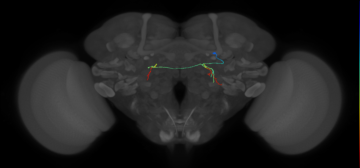 PS087_R (FlyEM-HB:1468030788)