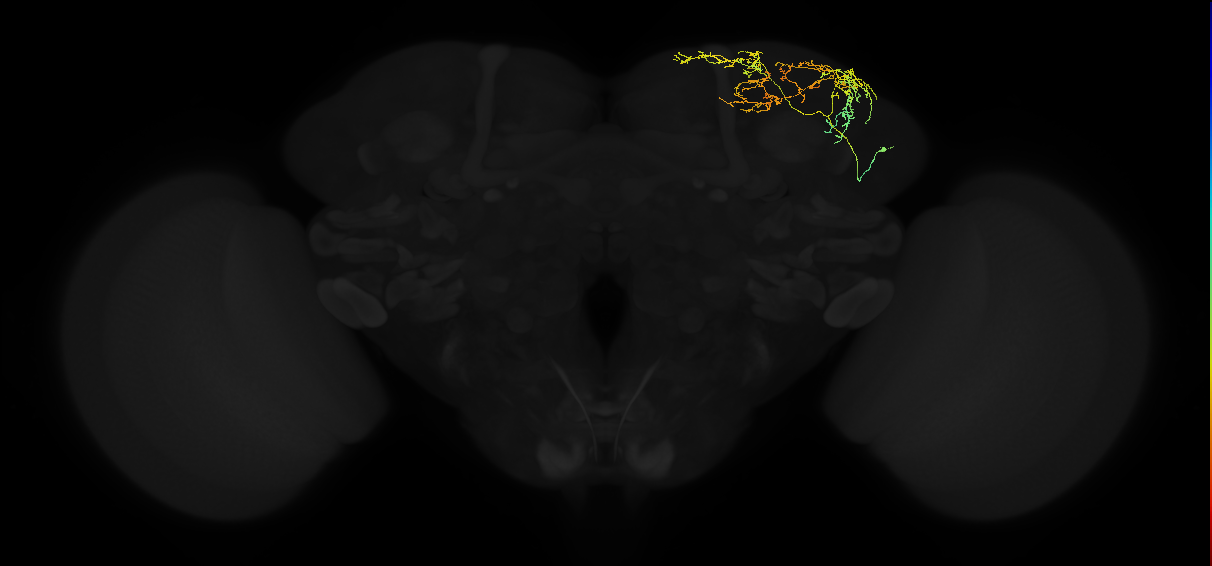 adult superior lateral protocerebrum neuron 181