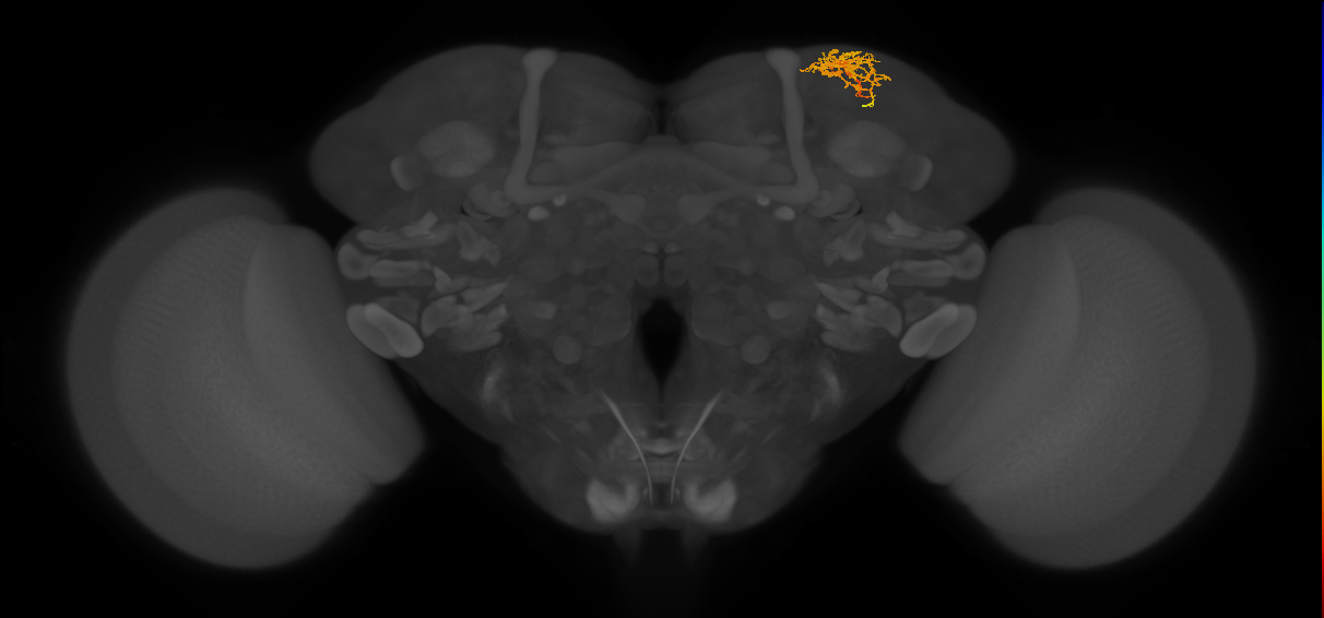 SLP300_R (FlyEM-HB:5813009356)