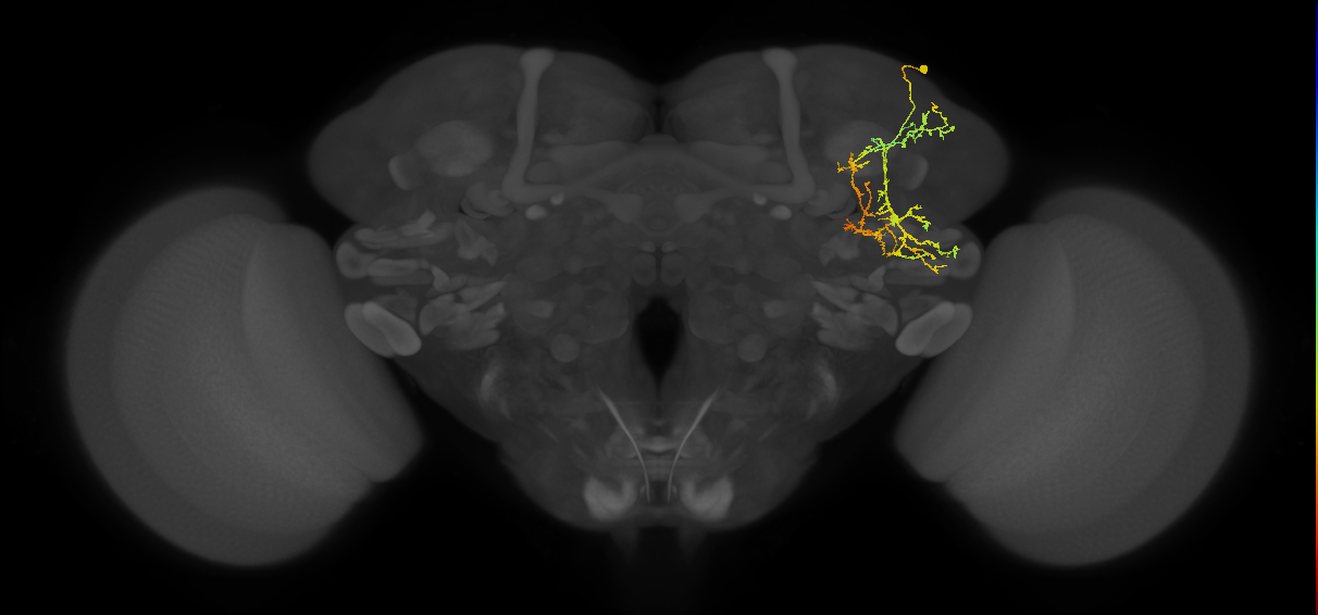 SLP306_R (FlyEM-HB:577123102)