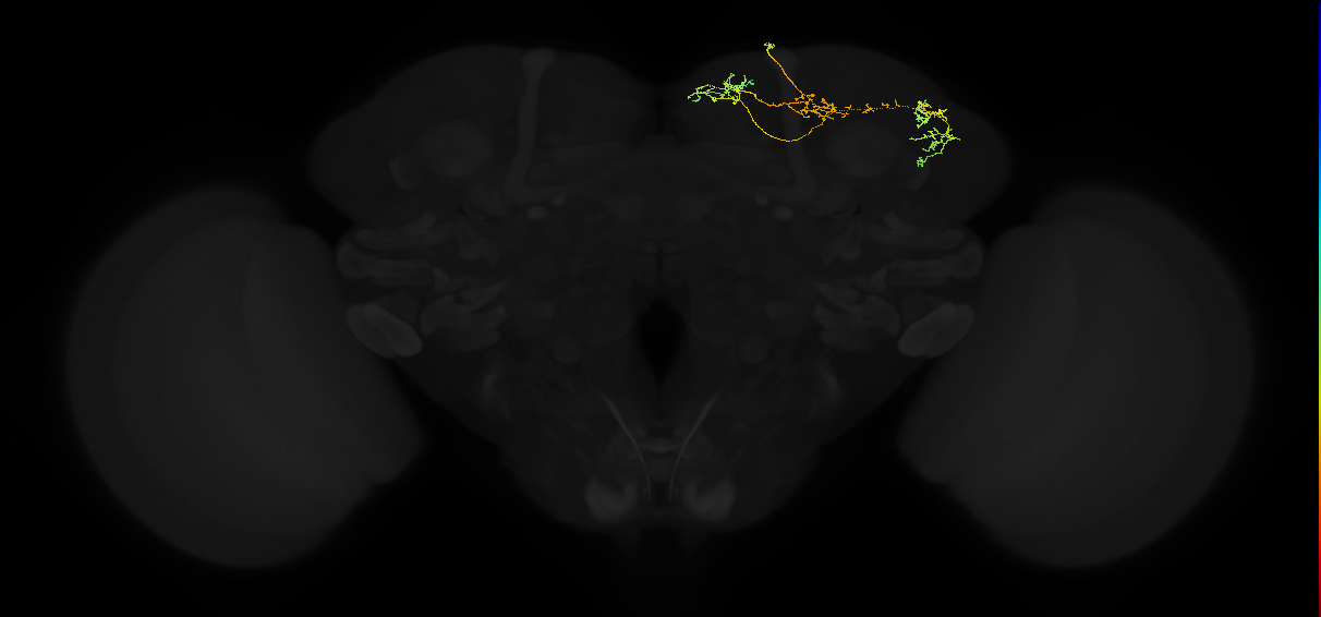 adult superior lateral protocerebrum neuron 399