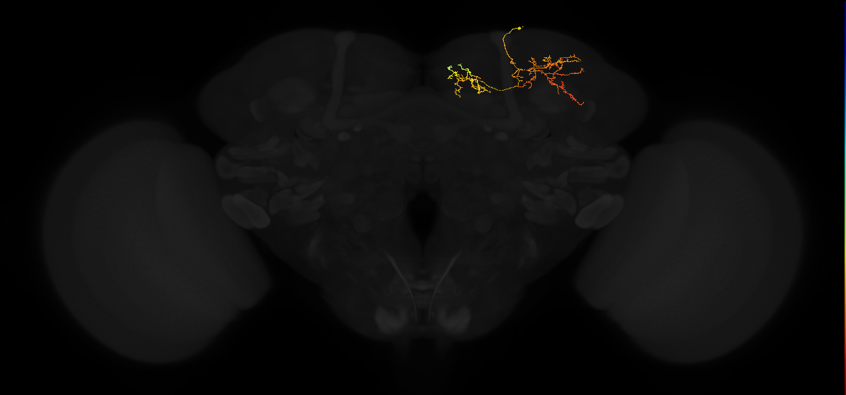 adult superior lateral protocerebrum neuron 402