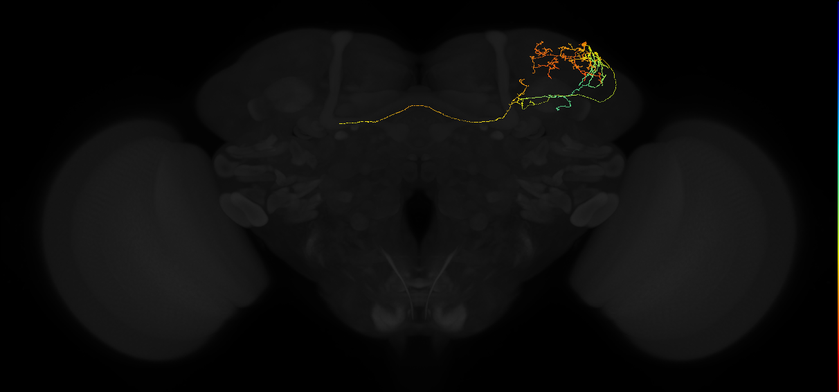 adult superior lateral protocerebrum neuron 465