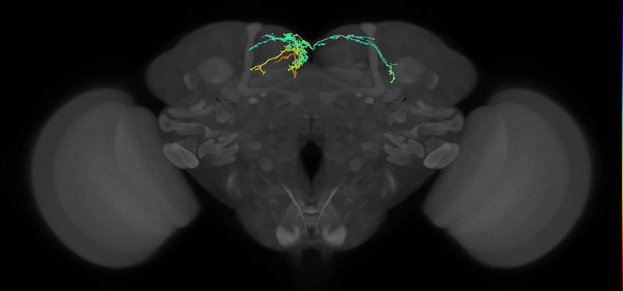 SMP093(ADM04)_L (FlyEM-HB:580732377)
