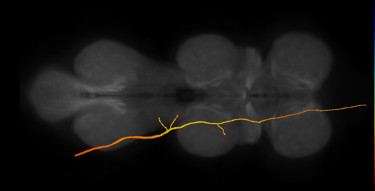 SApp30_DMetaN_L (MANC:10863)
