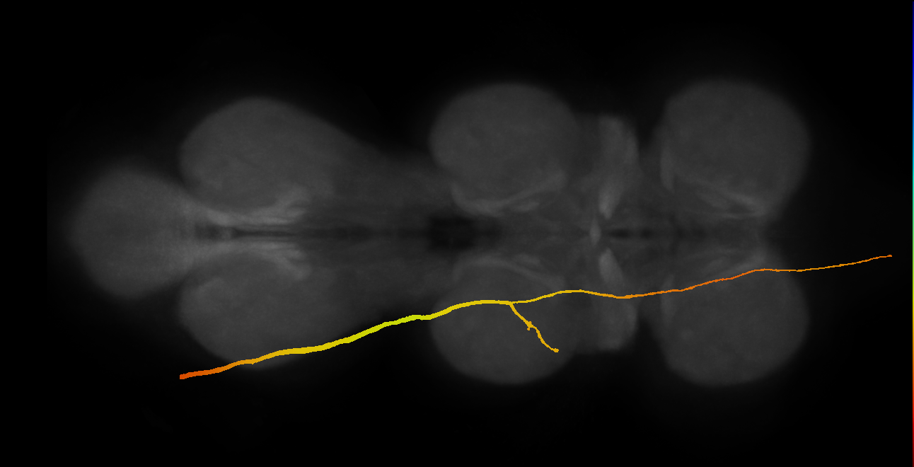 SApp31_DMetaN_L (MANC:12081)