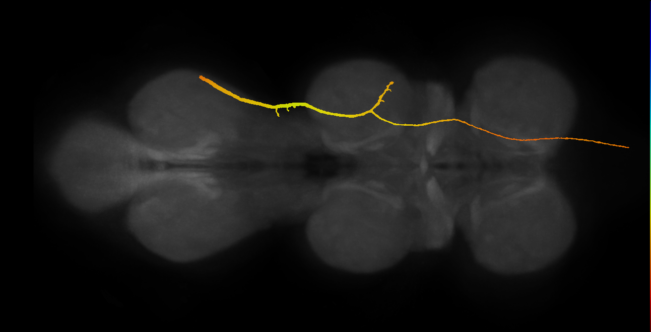 SApp31_DMetaN_R (MANC:12852)