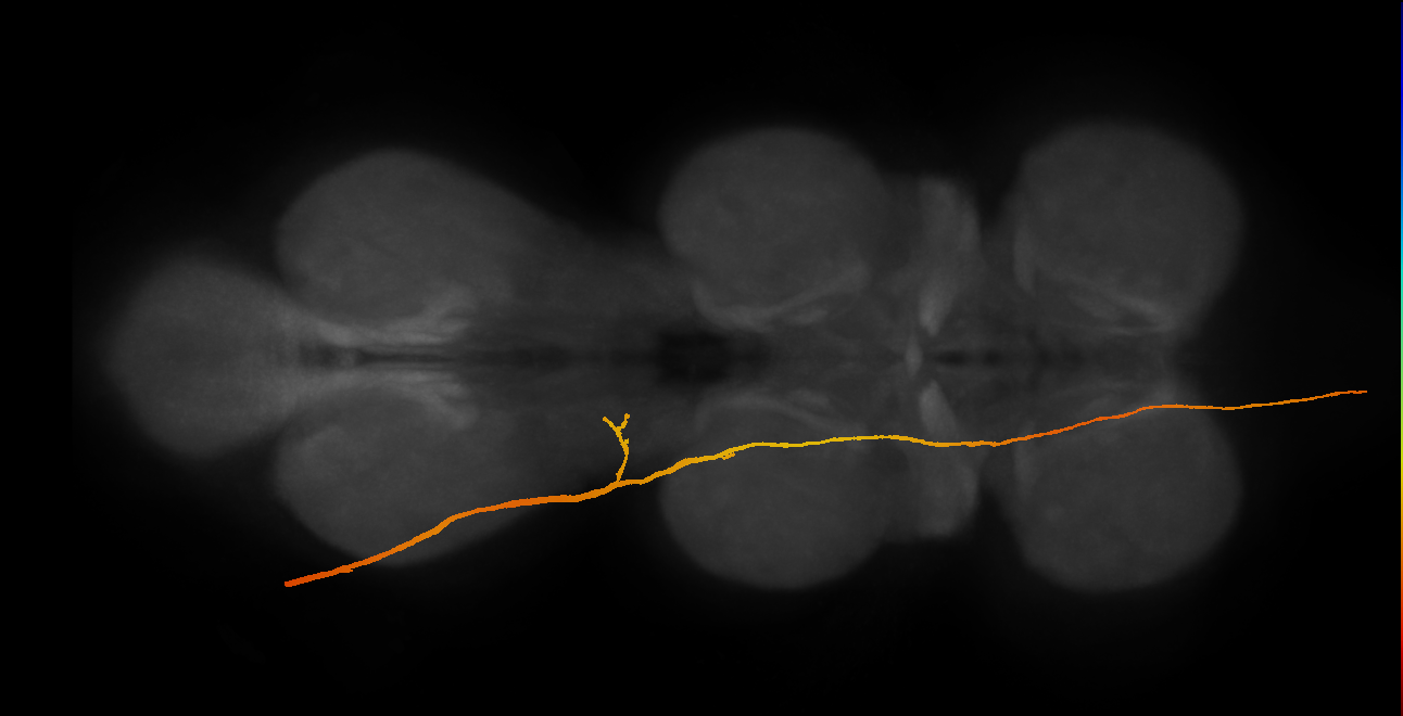 SApp26_DMetaN_L (MANC:14162)