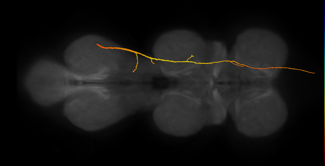 SApp28_DMetaN_R (MANC:14627)