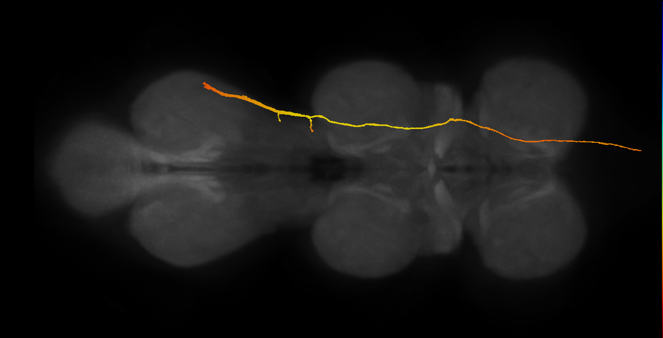 SApp31_DMetaN_R (MANC:14861)