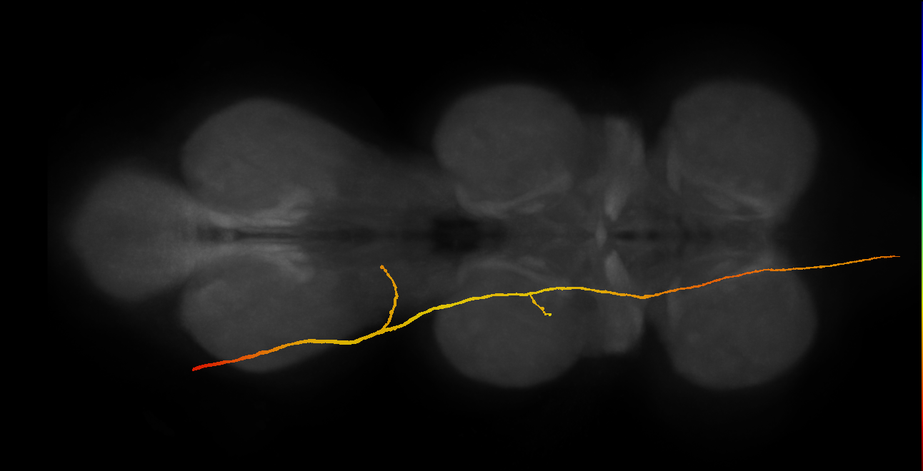 SApp28_DMetaN_L (MANC:14978)