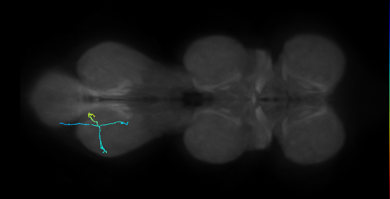 SNpp41_MetaLN_L (MANC:17604)