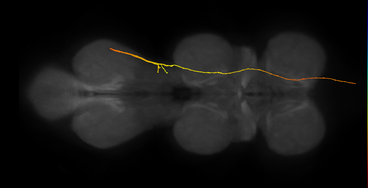 SApp28_DMetaN_R (MANC:18070)