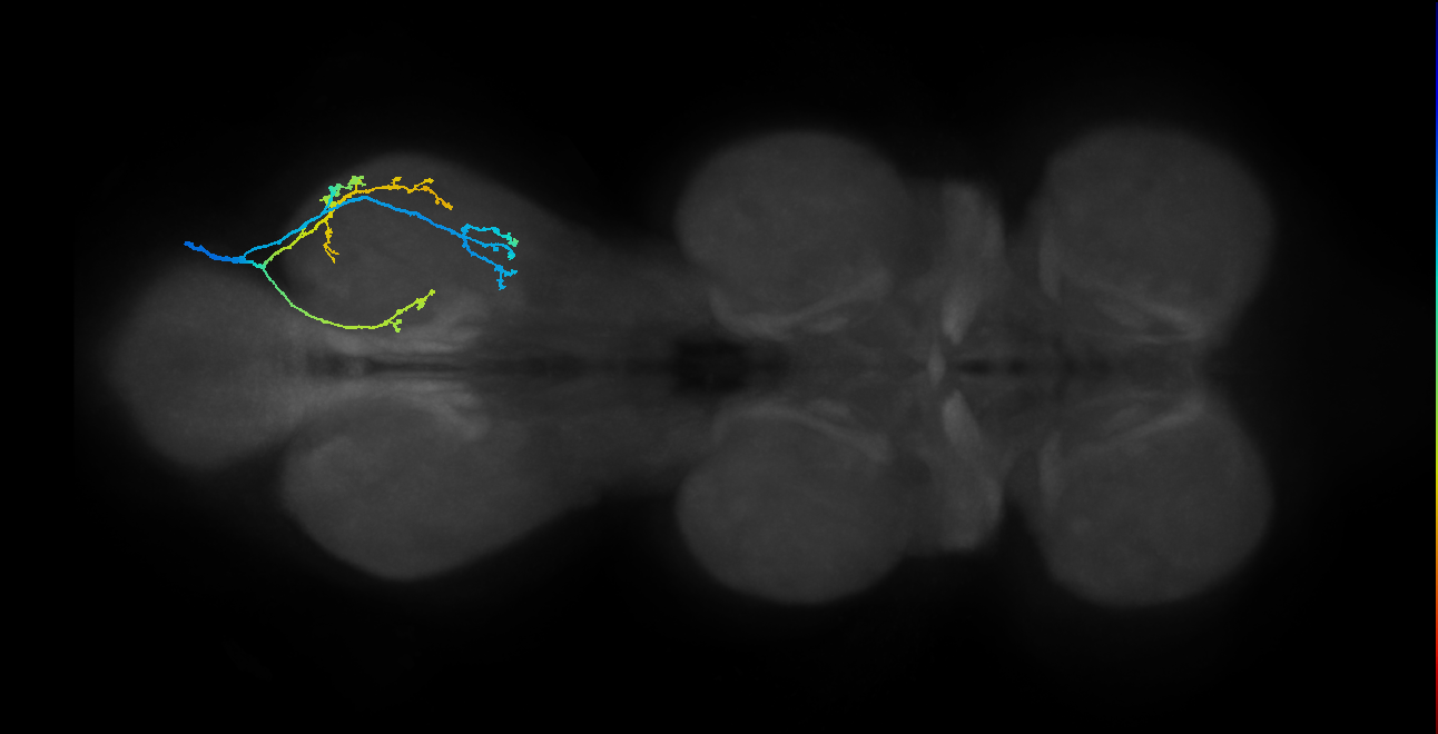 SNpp42_MetaLN_R (MANC:18935)