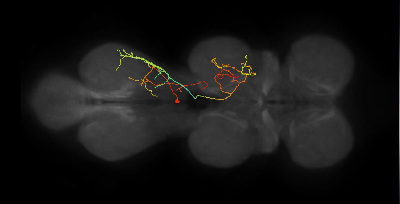 IN17A065_T3_R (MANC:20048)