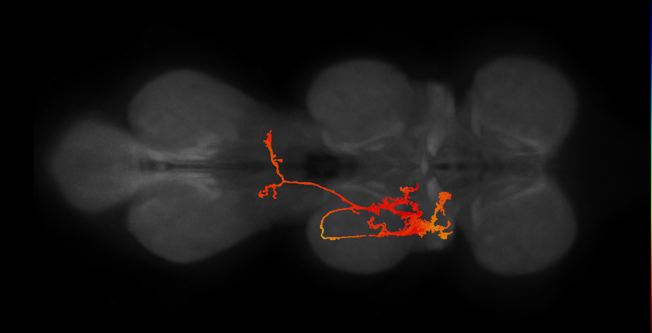IN11B001_T2_L (MANC:20190)