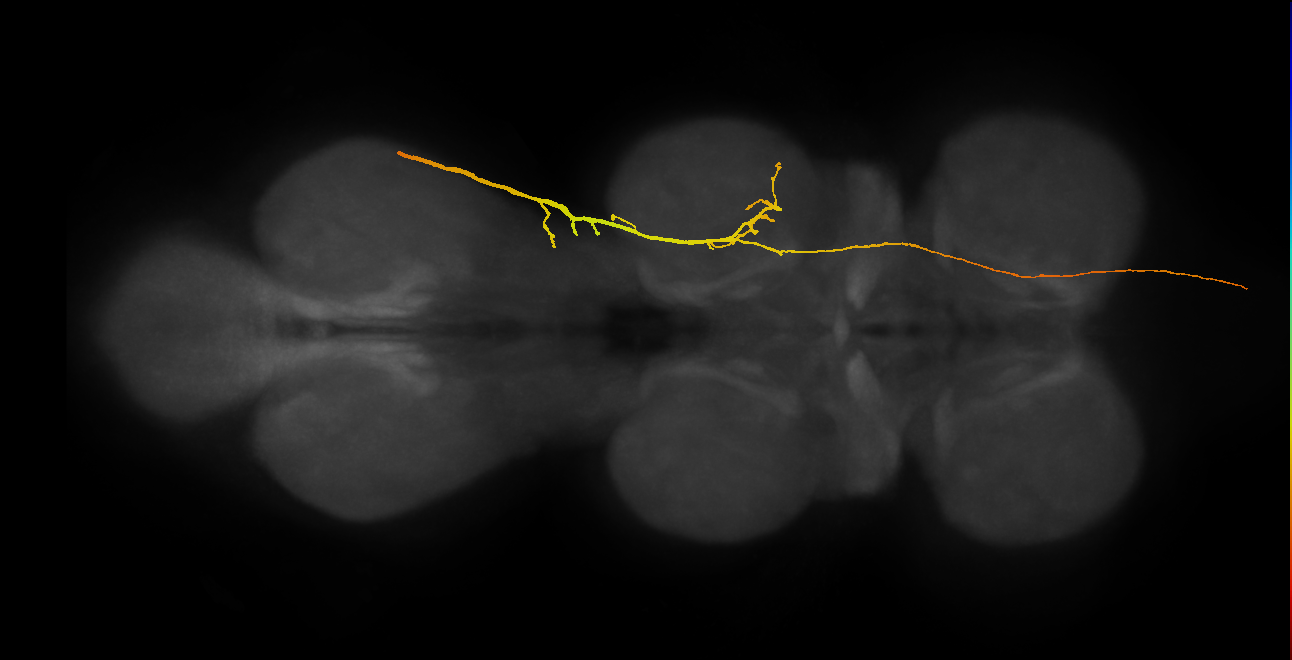 SApp21_DMetaN_R (MANC:20875)