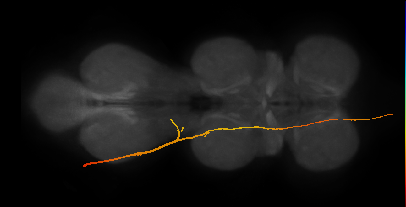 SApp30_DMetaN_L (MANC:21556)