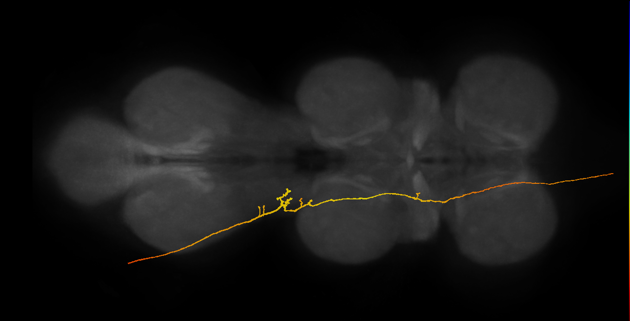 SApp25_DMetaN_L (MANC:22494)