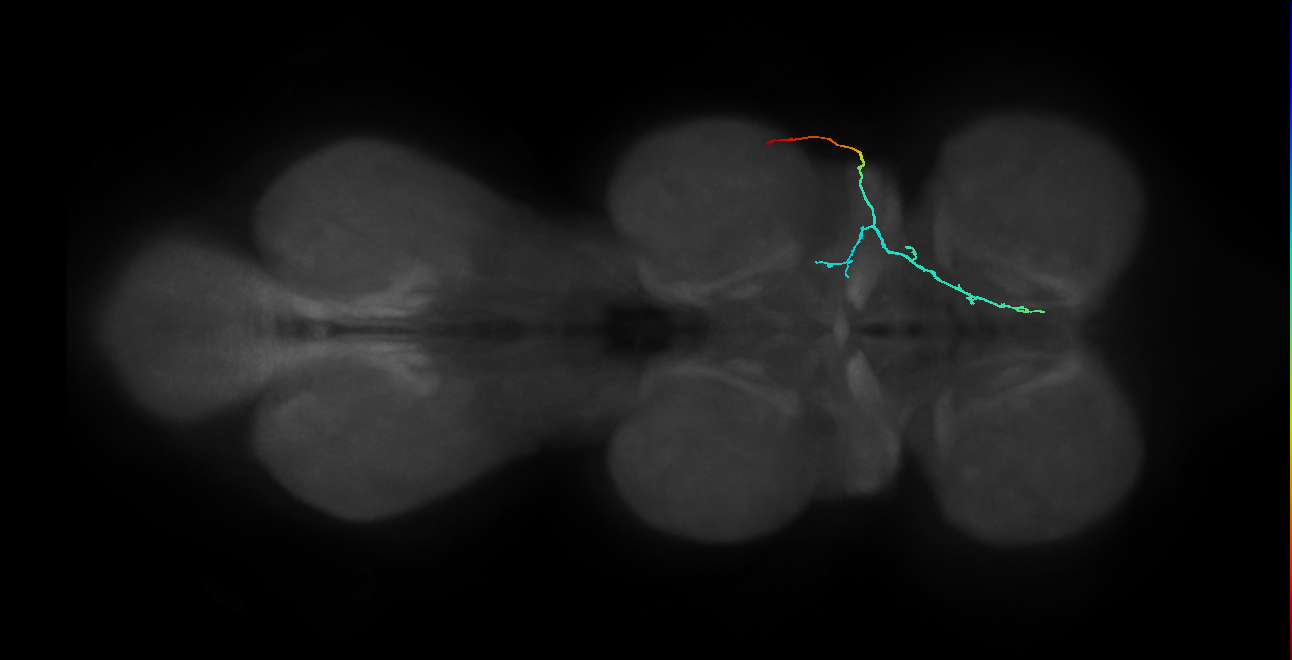 SNta11_PDMN_R (MANC:25077)