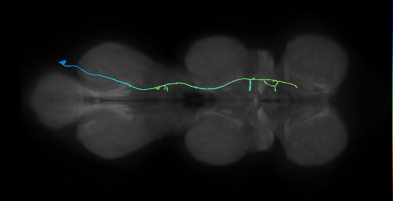 SNpp47_MetaLN_R (MANC:25369)