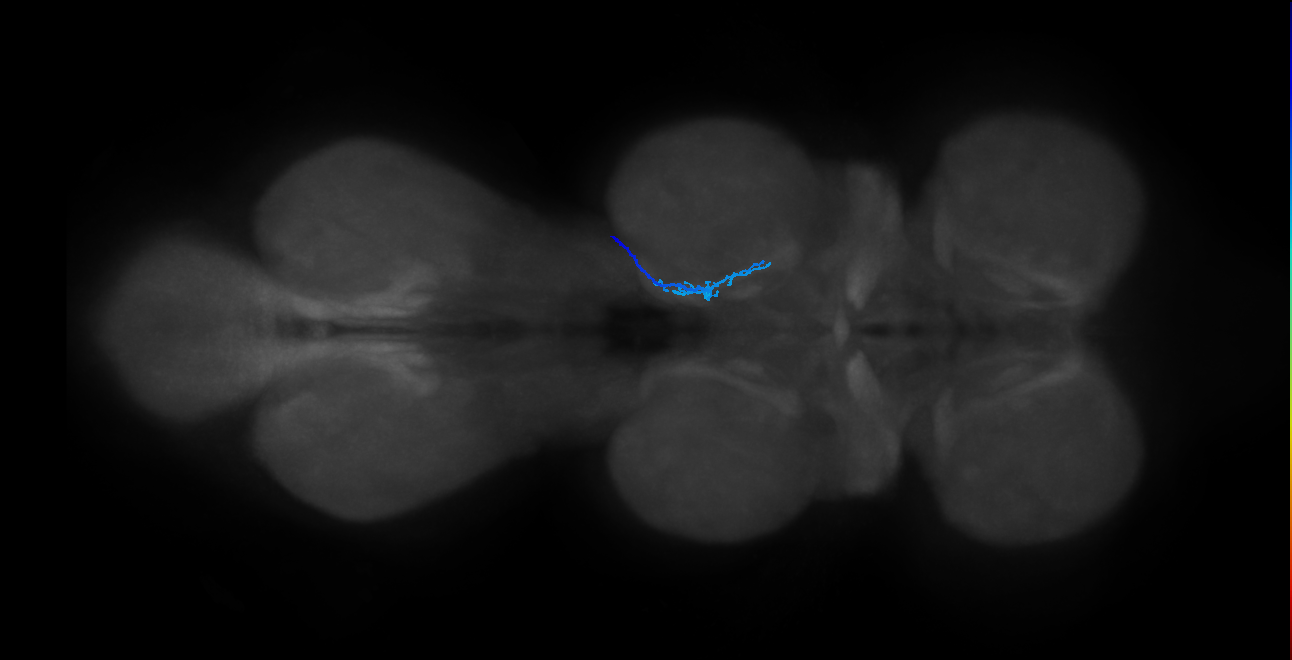 SNta20_MesoLN_R (MANC:26289)