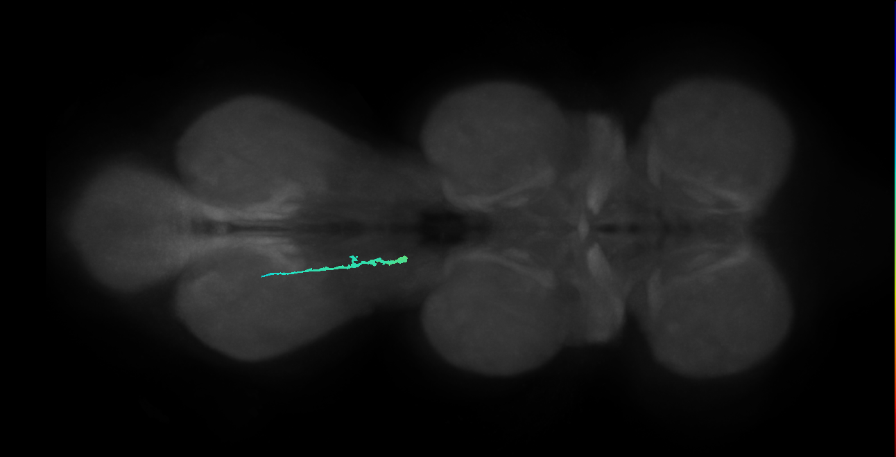 SNpp39_MetaLN_L (MANC:27253)