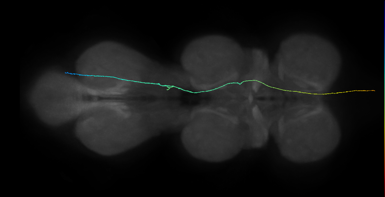 SApp40_MetaLN_R (MANC:28571)