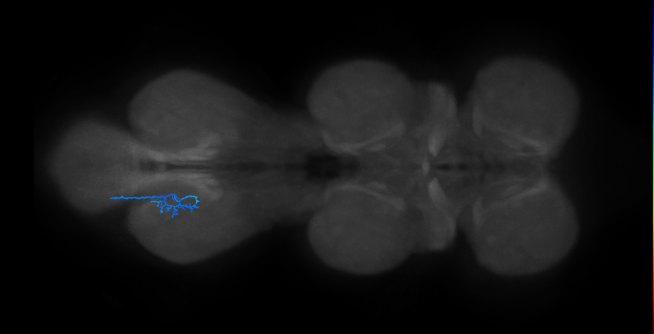 SNta22_MetaLN_L (MANC:28783)