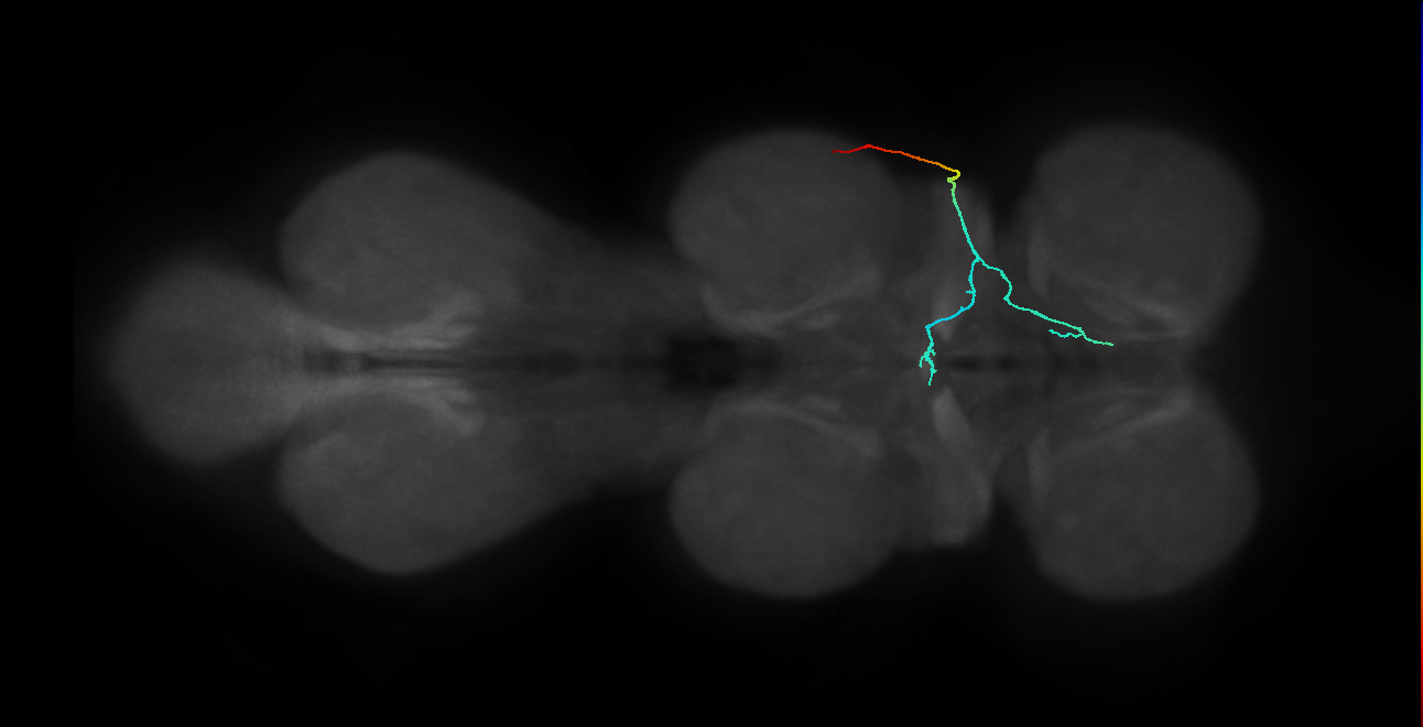 SNta11_PDMN_R (MANC:29443)