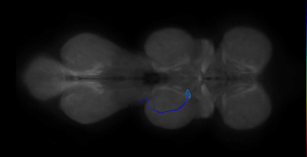 SNta15_MesoLN_L (MANC:29471)