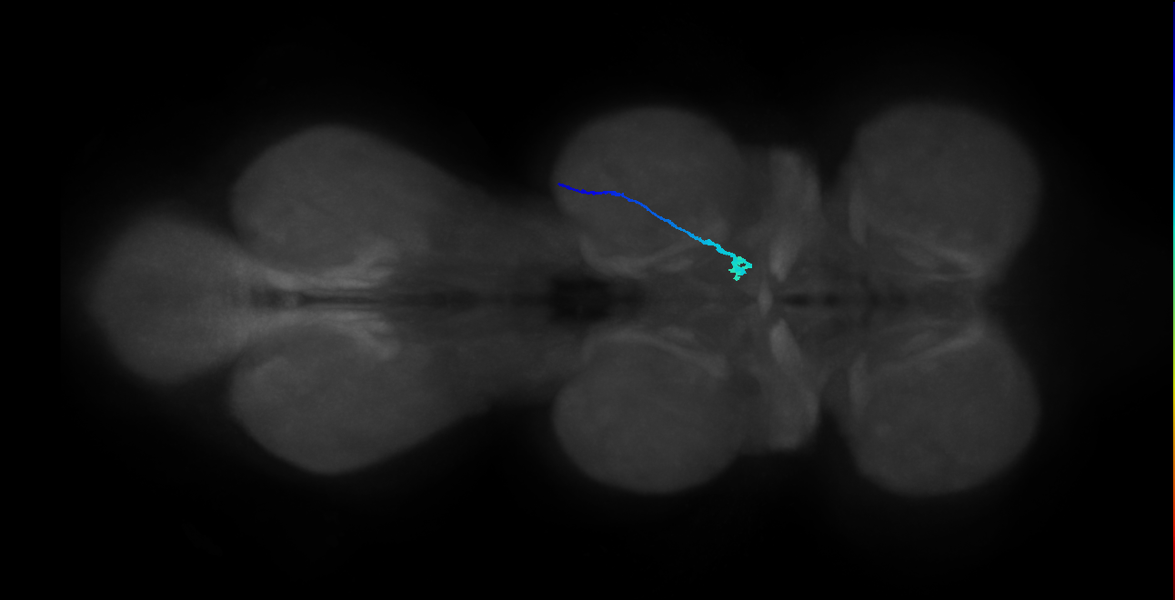 SNpp37_MesoLN_R (MANC:29686)