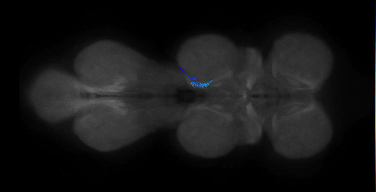 SNta20_MesoLN_R (MANC:30313)