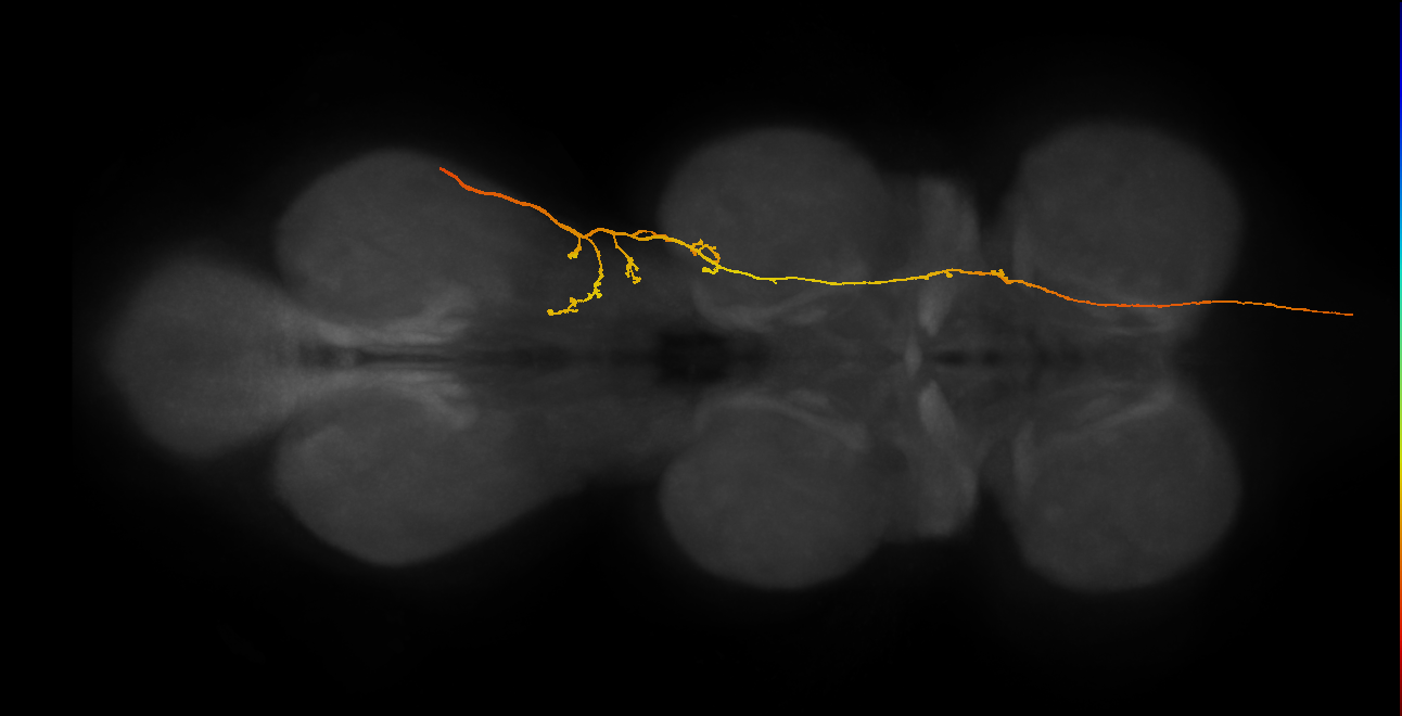 SApp18_DMetaN_R (MANC:30491)