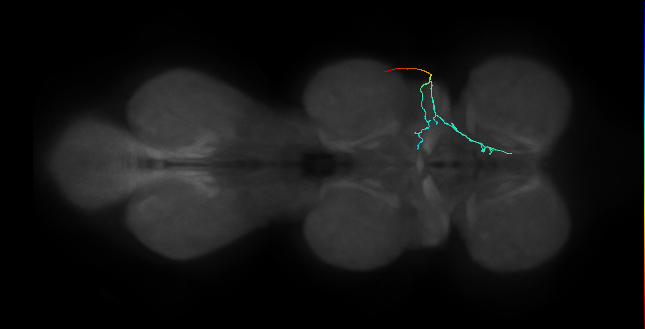 SNta11_PDMN_R (MANC:31287)