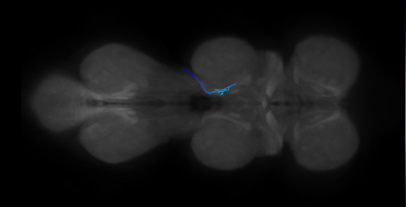 SNta20_MesoLN_R (MANC:31297)