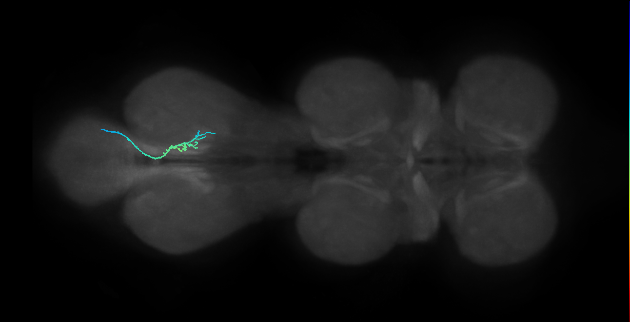 SNta17_MetaLN_R (MANC:31344)