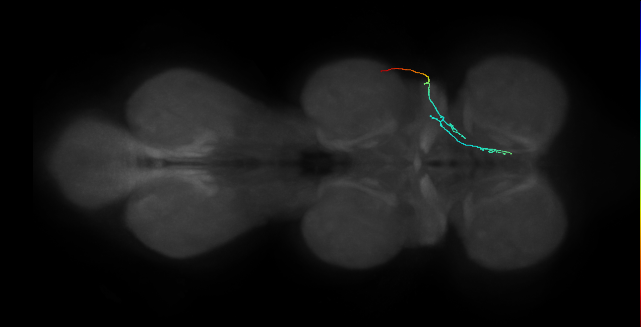 SNta11_PDMN_R (MANC:32609)