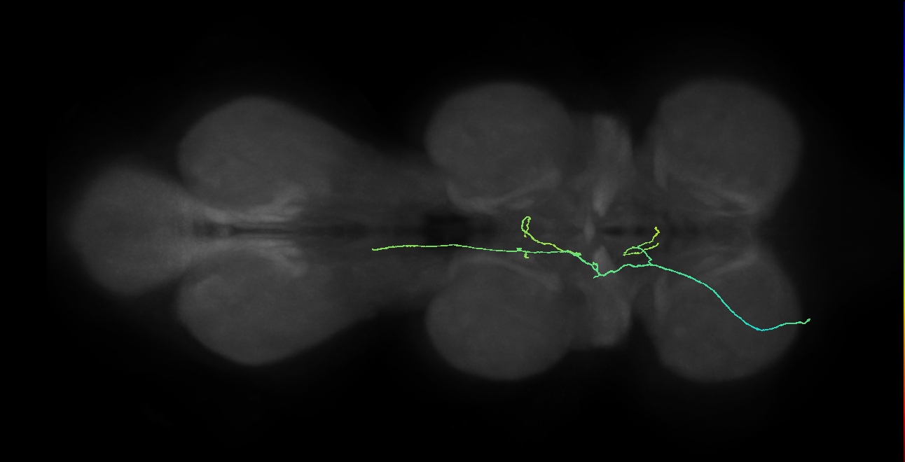 SNppxx_ProCN_L (MANC:32637)