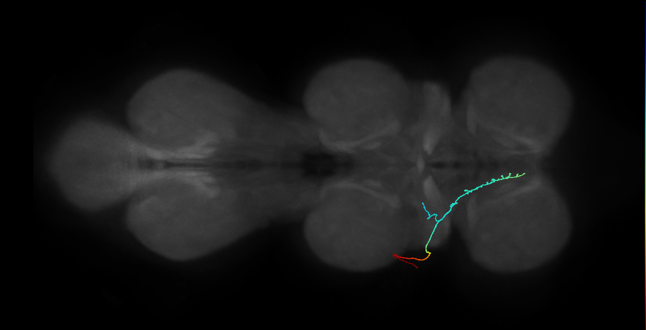SNta11_PDMN_L (MANC:32774)