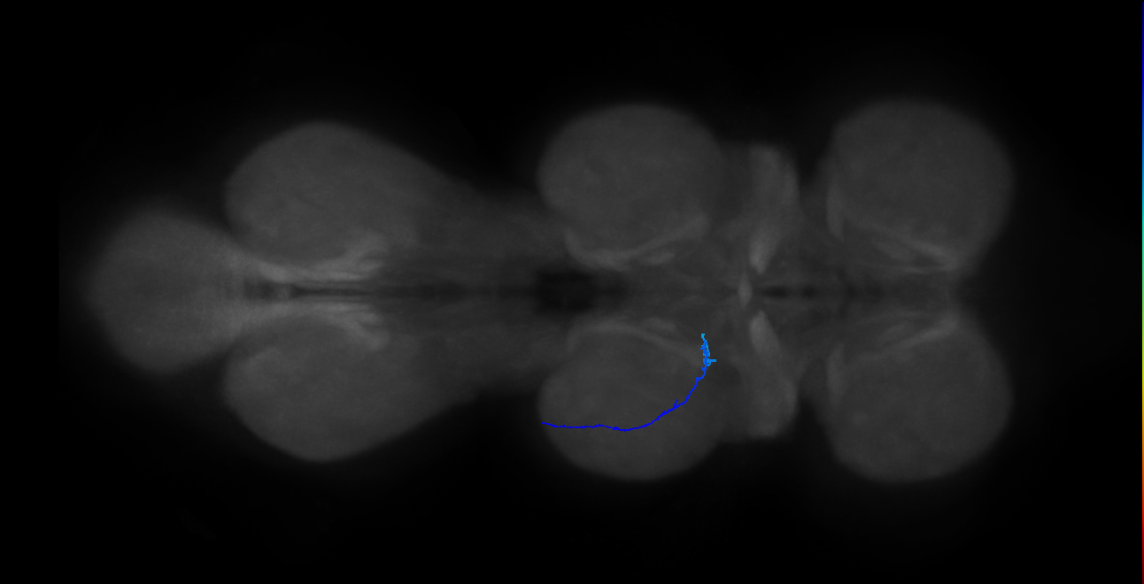 SNta16_MesoLN_L (MANC:32844)
