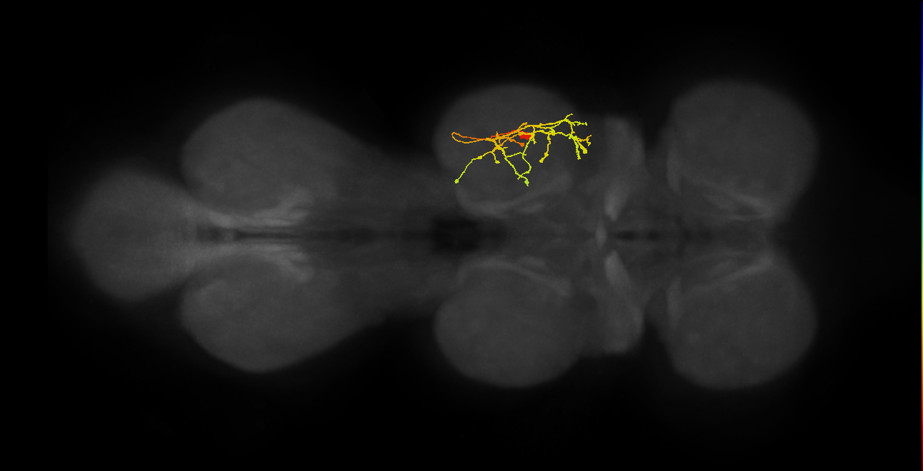 IN11B027_T2_R (MANC:33659)