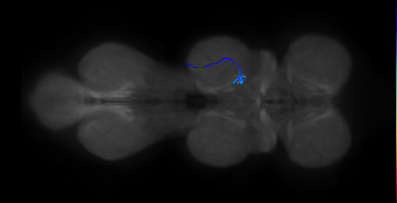 SNta24_MesoLN_R (MANC:34117)