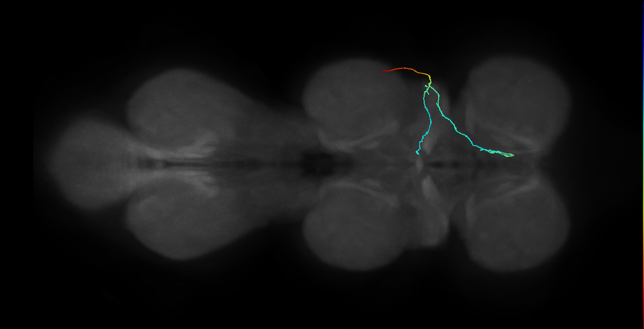 SNta11_PDMN_R (MANC:34613)