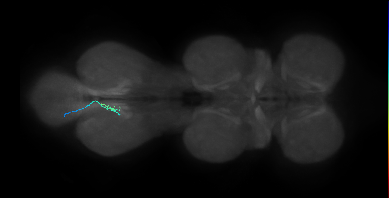 SNta20_MetaLN_L (MANC:35358)