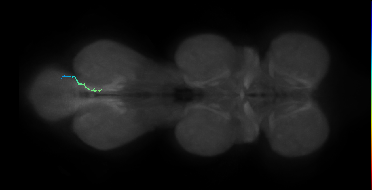 SNta17_MetaLN_R (MANC:38301)