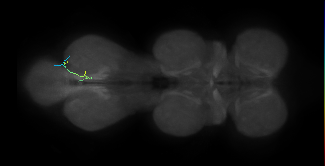 SNta17_MetaLN_R (MANC:38946)